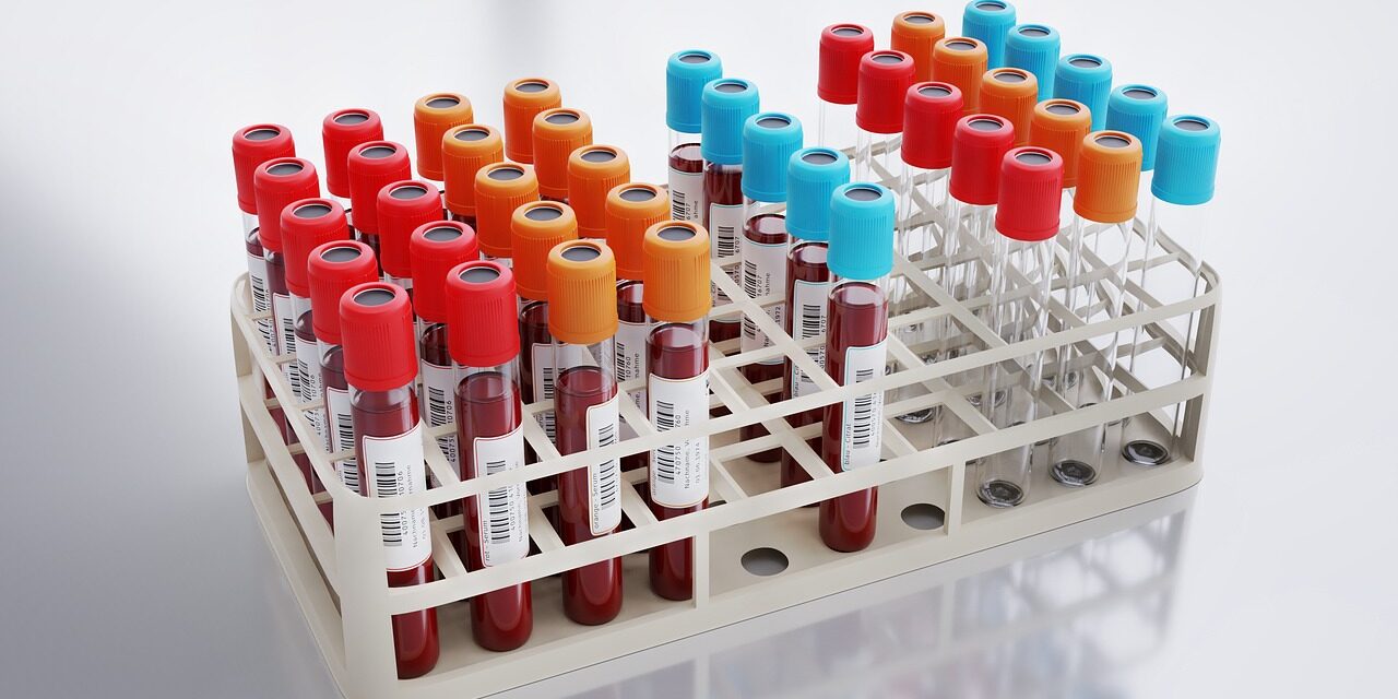 De ce este important să faci analize medicale chiar dacă nu ai simptome?